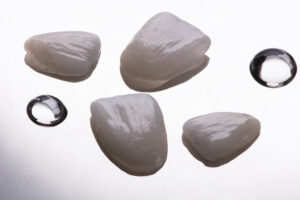 ALL CERAMIC DENTAL CROWNS 5 ceramic dental crowns