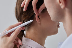 EAR CORRECTION 5 ear correction