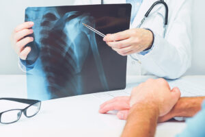 SHOULDER ROTATOR CUFF REPAIR 5 a doctor showing a x-ray to a patient