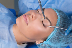 Upper Eyelid Removal 2