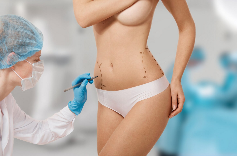 vaser liposuction