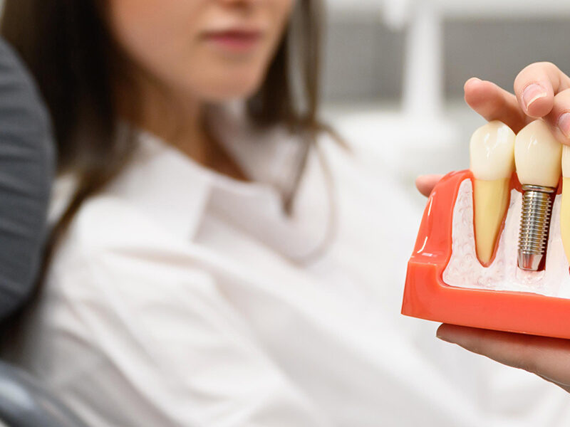 root canal treatment