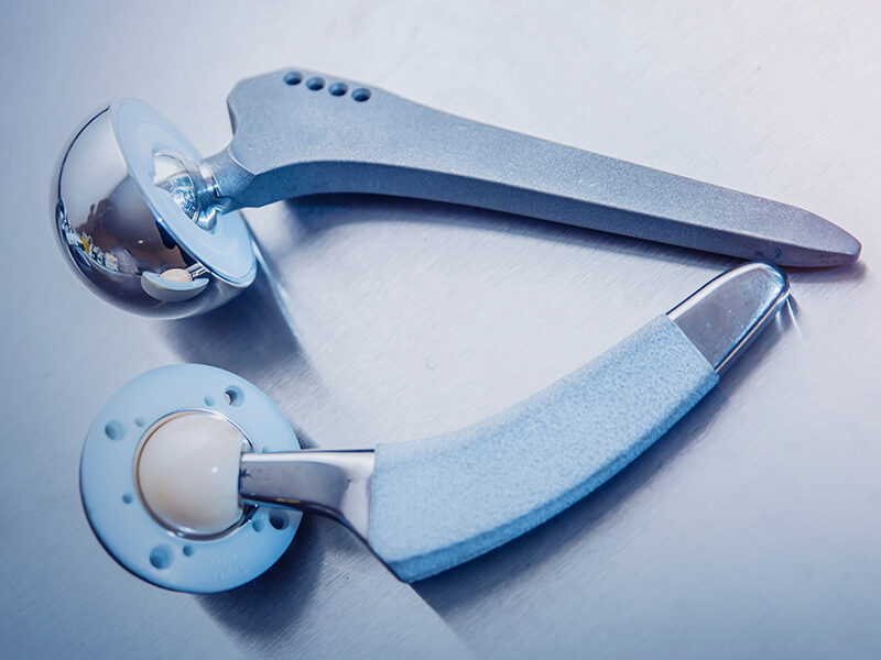 hip replacement surgery