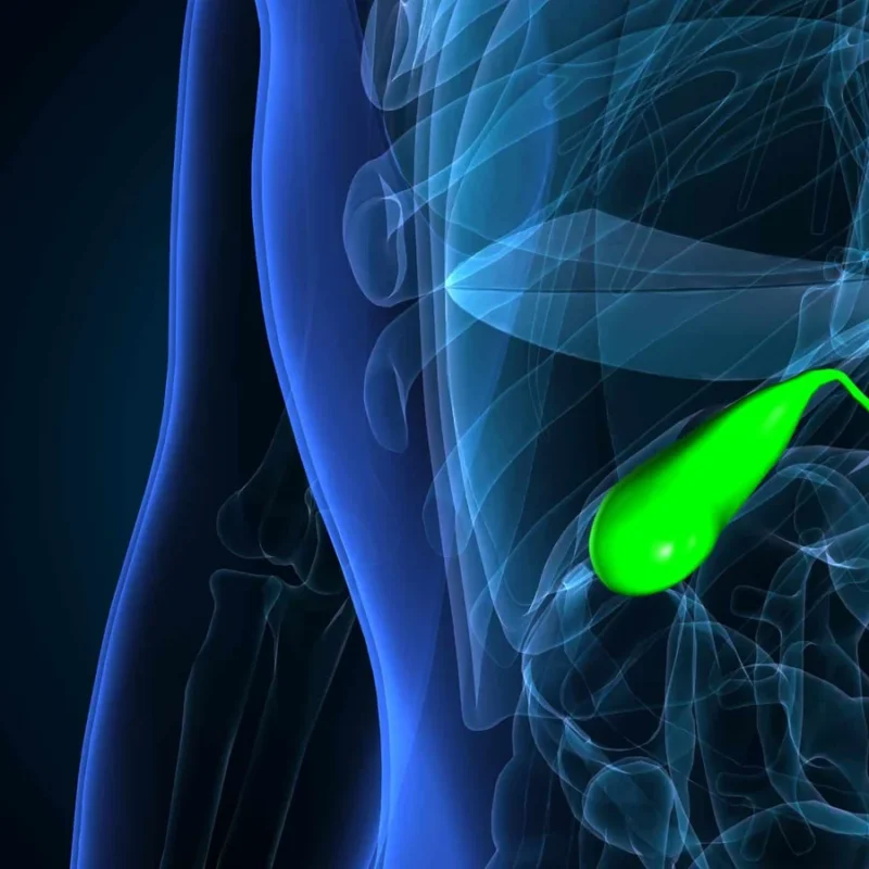 pancreatic cancer surgery